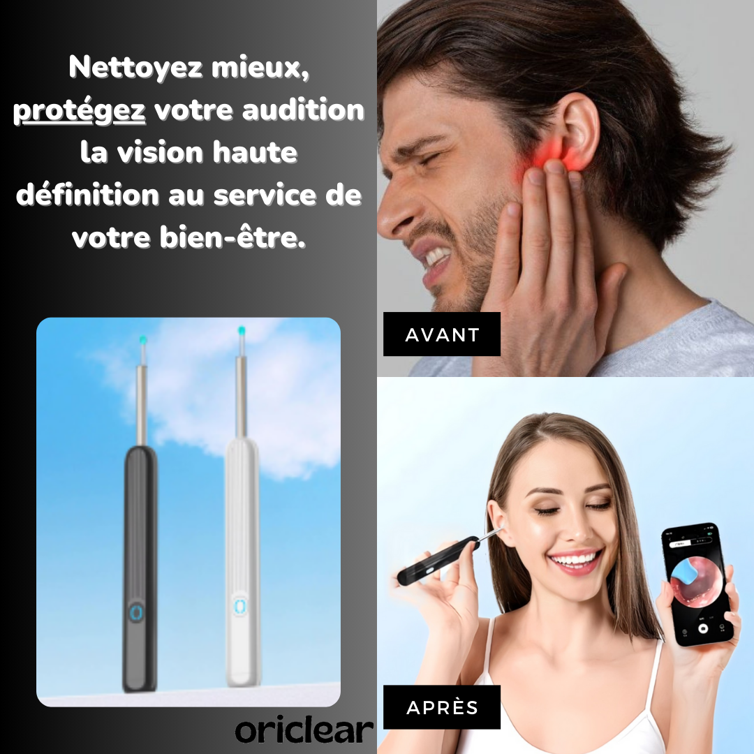 KIT NETTOYEUR D’OREILLES VISUEL