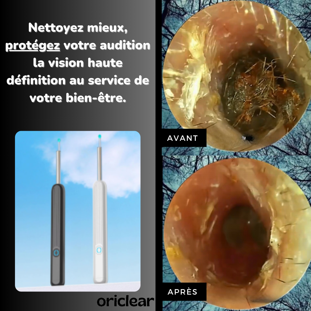 KIT NETTOYEUR D’OREILLES VISUEL